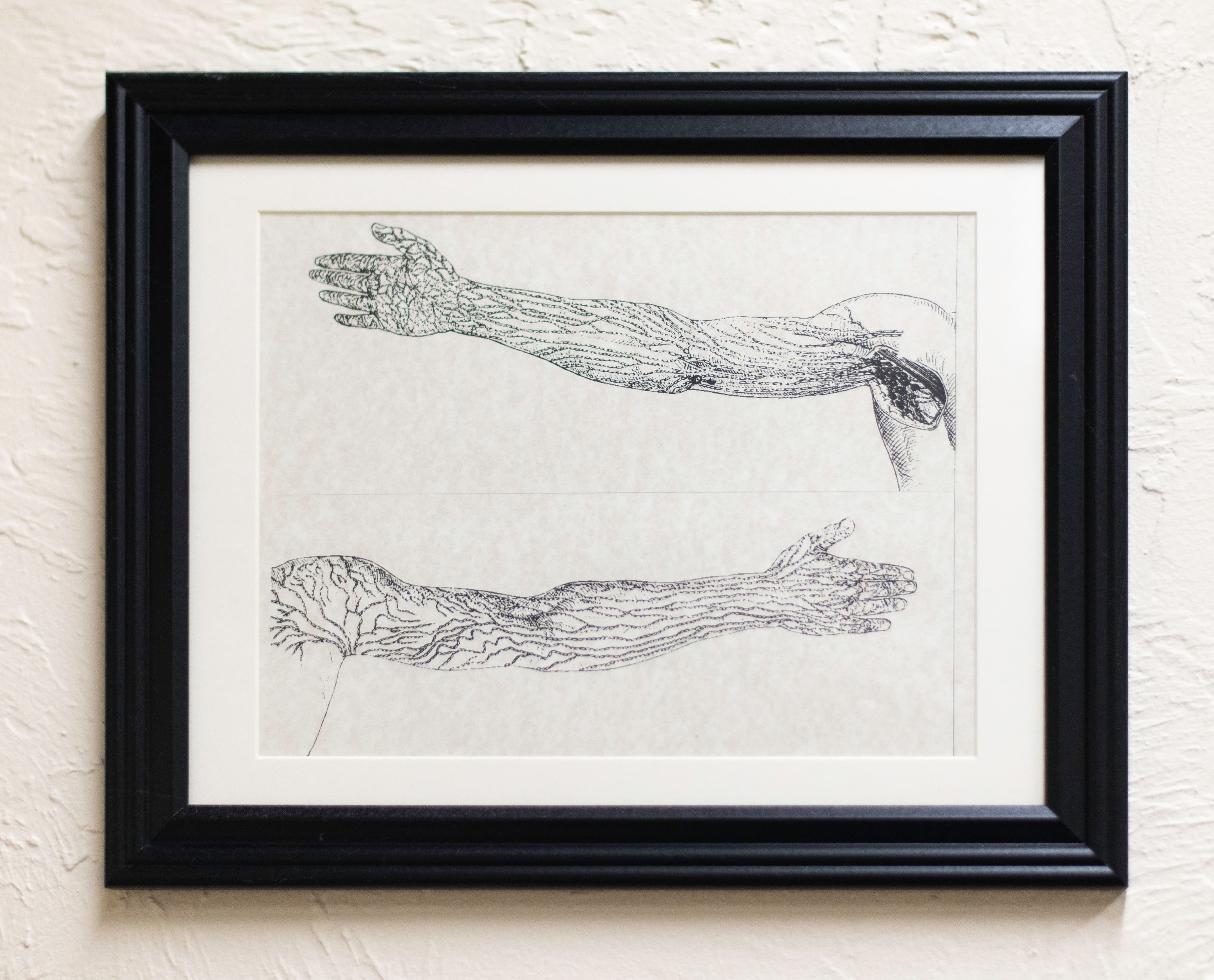 Anatomical diagram of an arm.